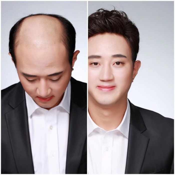 당진가발김호증모가발행복미용실 갤러리 5