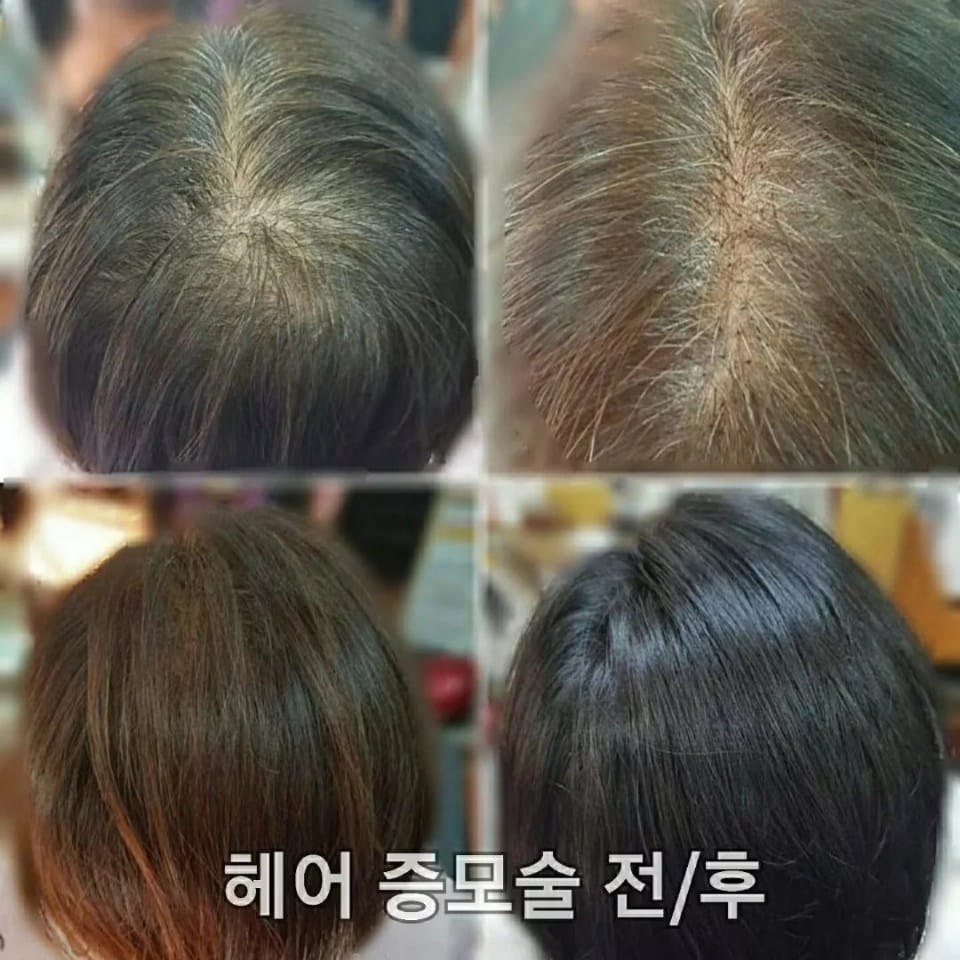 당진가발김호증모가발행복미용실 갤러리 9