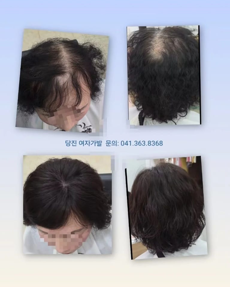 당진가발김호증모가발행복미용실 갤러리 8