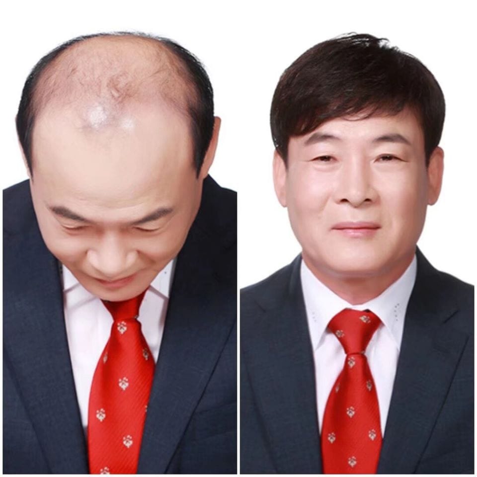 당진가발김호증모가발행복미용실 갤러리 6
