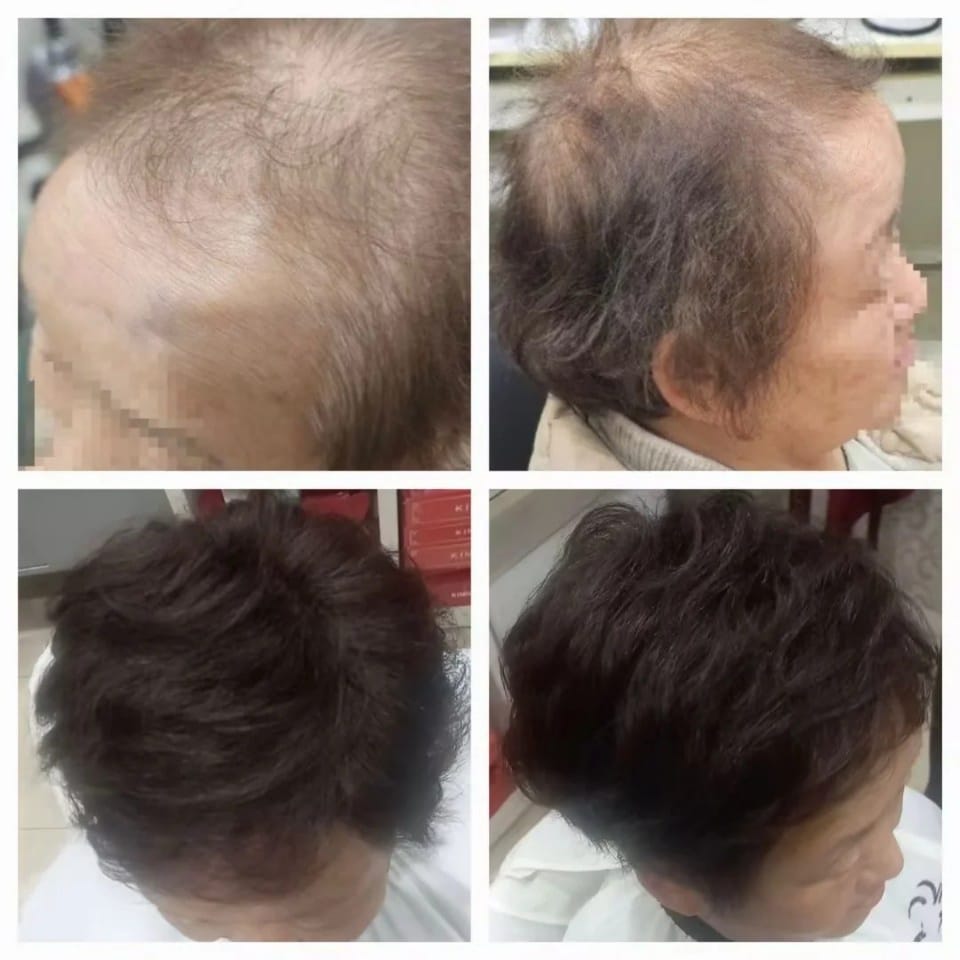 당진가발김호증모가발행복미용실 갤러리 10