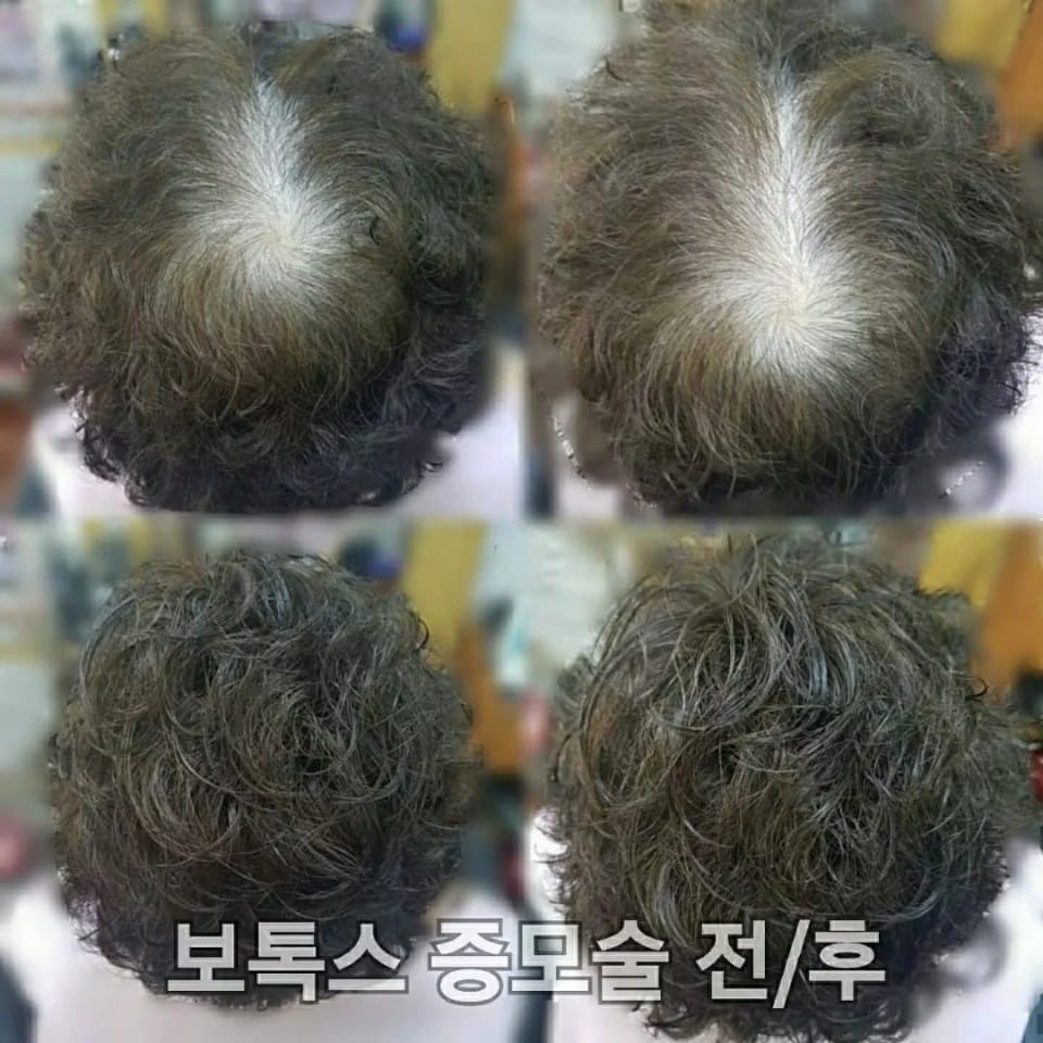 당진가발김호증모가발행복미용실 갤러리 12